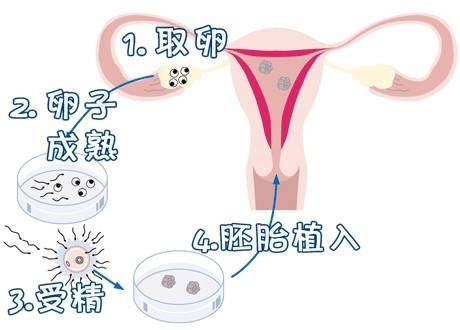 有偿捐卵供卵招聘生殖中心